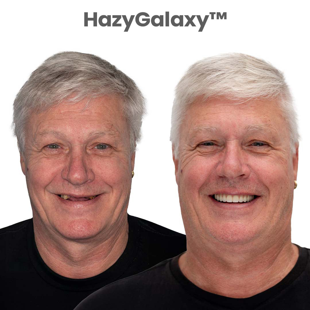 ⭐HazyGalaxy™ Custom-Fit Dentures ⏰ ENDS TODAY 70% OFF | Smile with Confidence