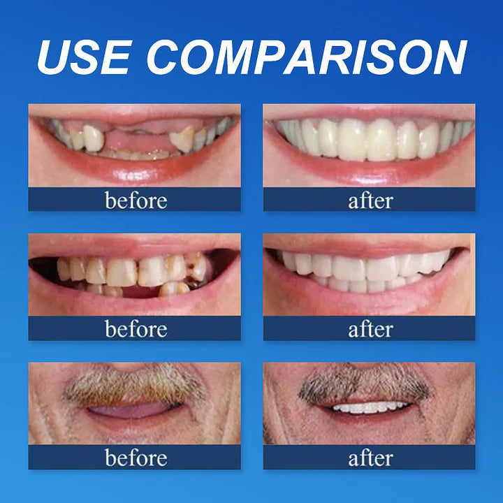 Medical Full Denture with Strong Suctiond🦷